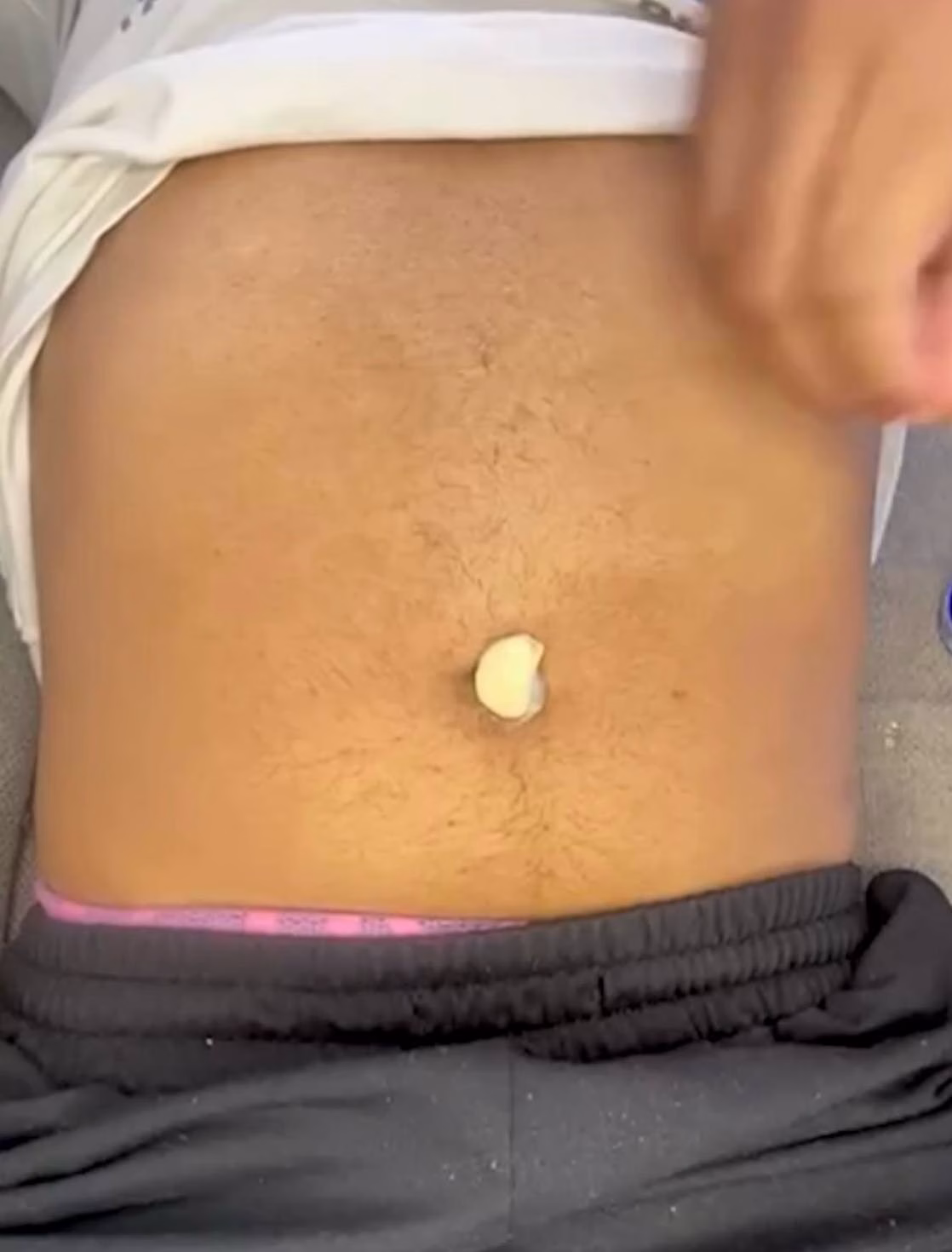 Solo un ajo en el ombligo y Vick VapoRub