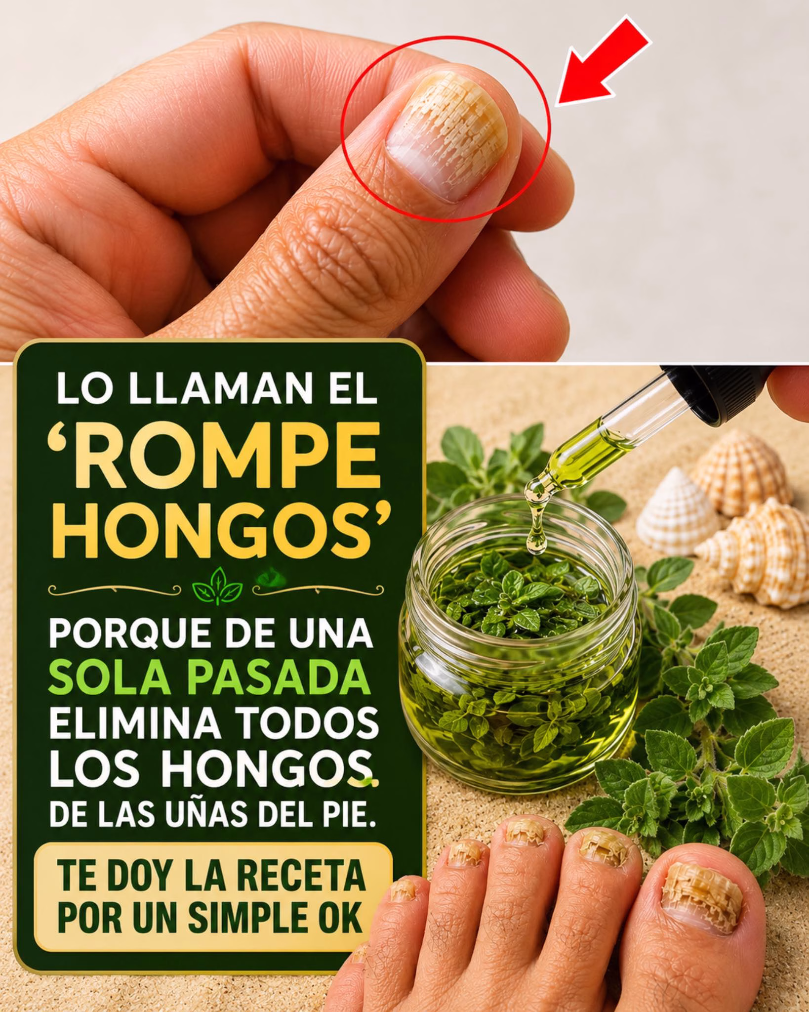 Cómo eliminar hongos en las uñas con estas 3 recetas caseras fáciles