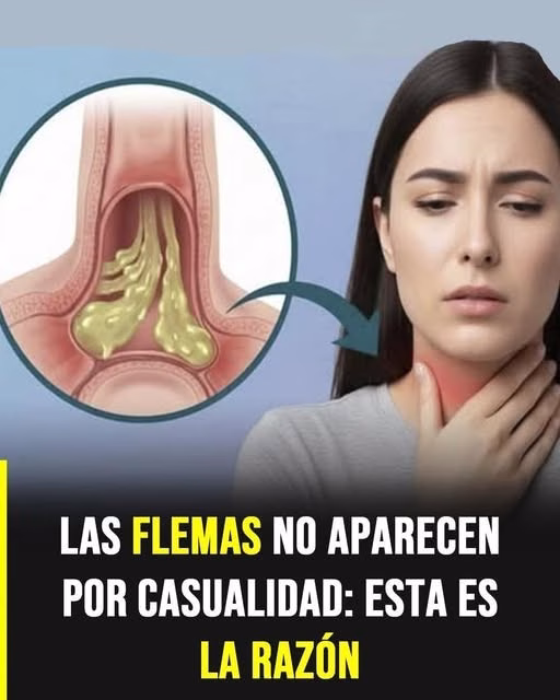 Zanahoria, limón y miel, sacará la gripe, sanará la tos y limpiará tus pulmones de la flema, prepáralo de esta forma.
