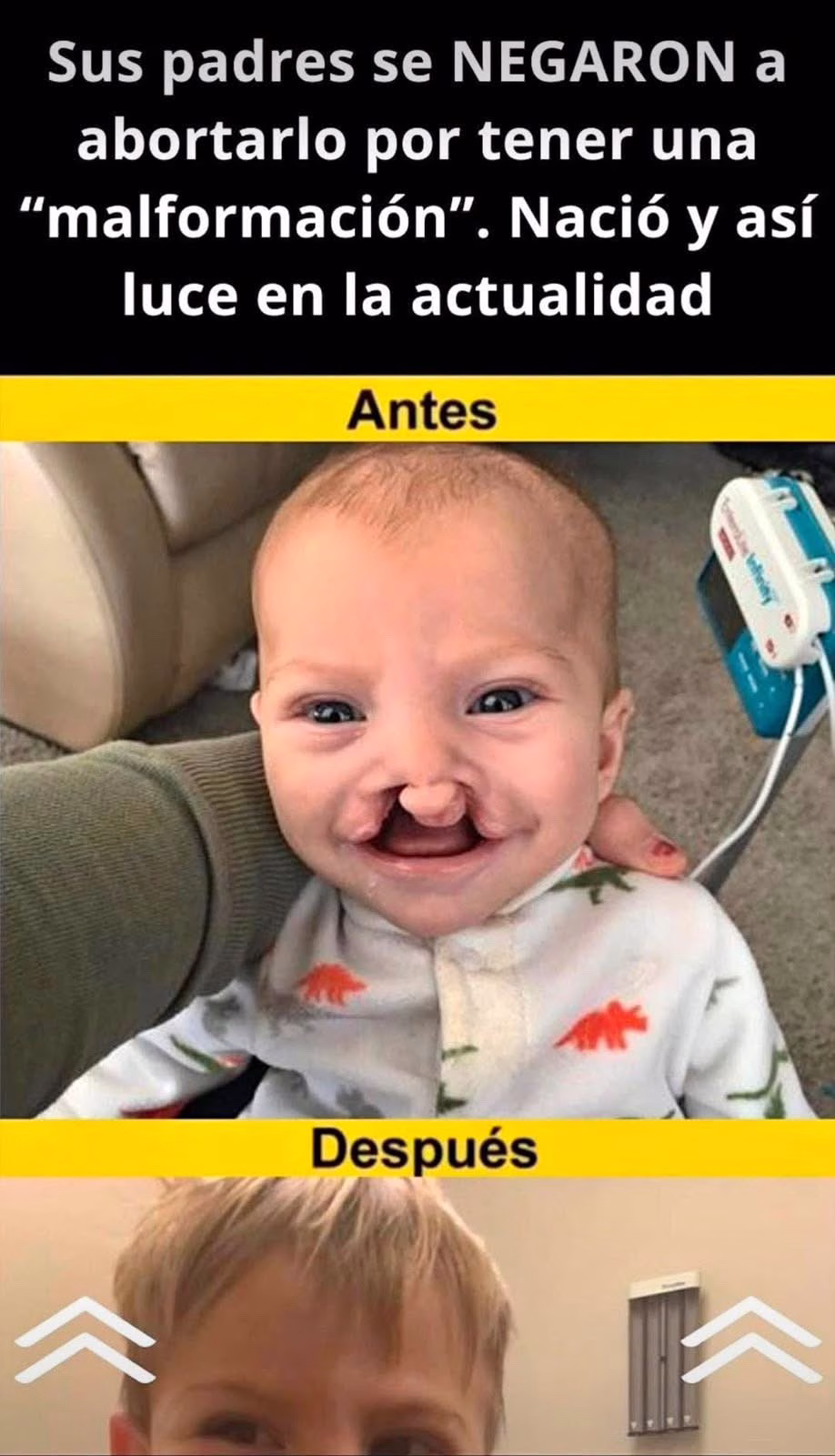 Un niño que desafió todos los pronósticos: una historia de valentía, esperanza y amor incondicional