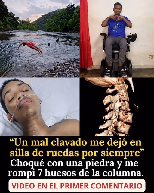 Video: Se lanzó de cabeza al agua y todo cambió en segundos médicos explican por qué un golpe en el cuello puede causar una lesión medular irreversible